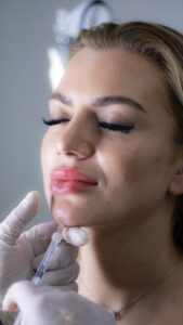 Dermal Fillers Can Be Reversed With Hylenex
