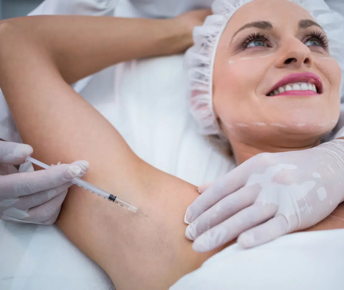 Botox for Underarm Sweating