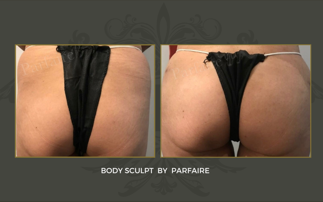 Body sculpt
