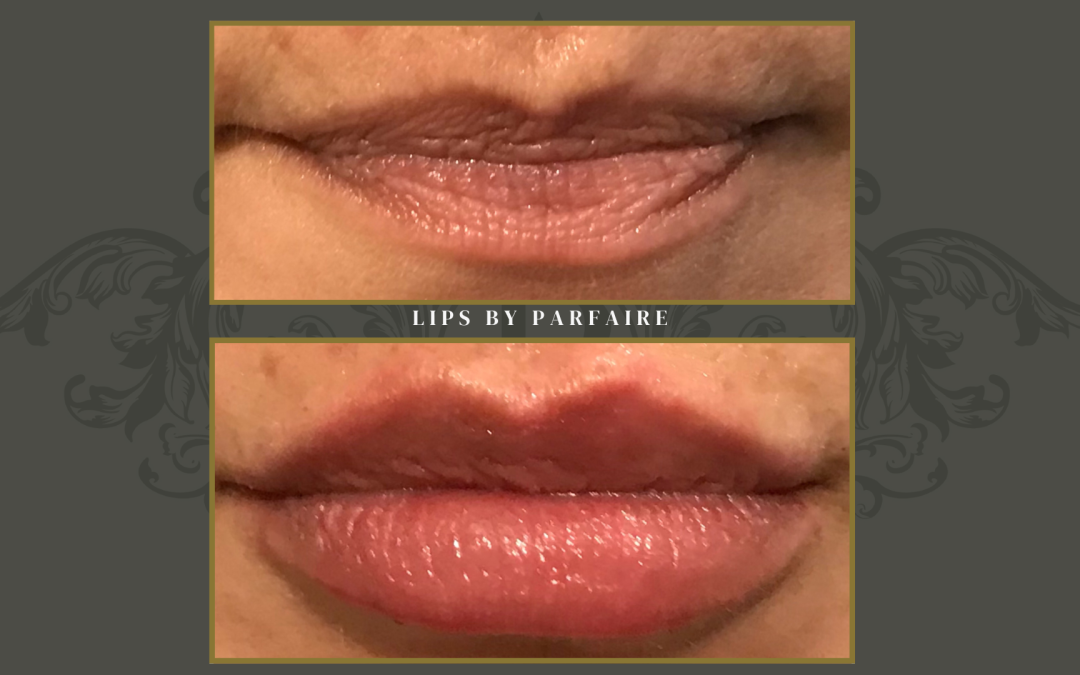 lips (2)