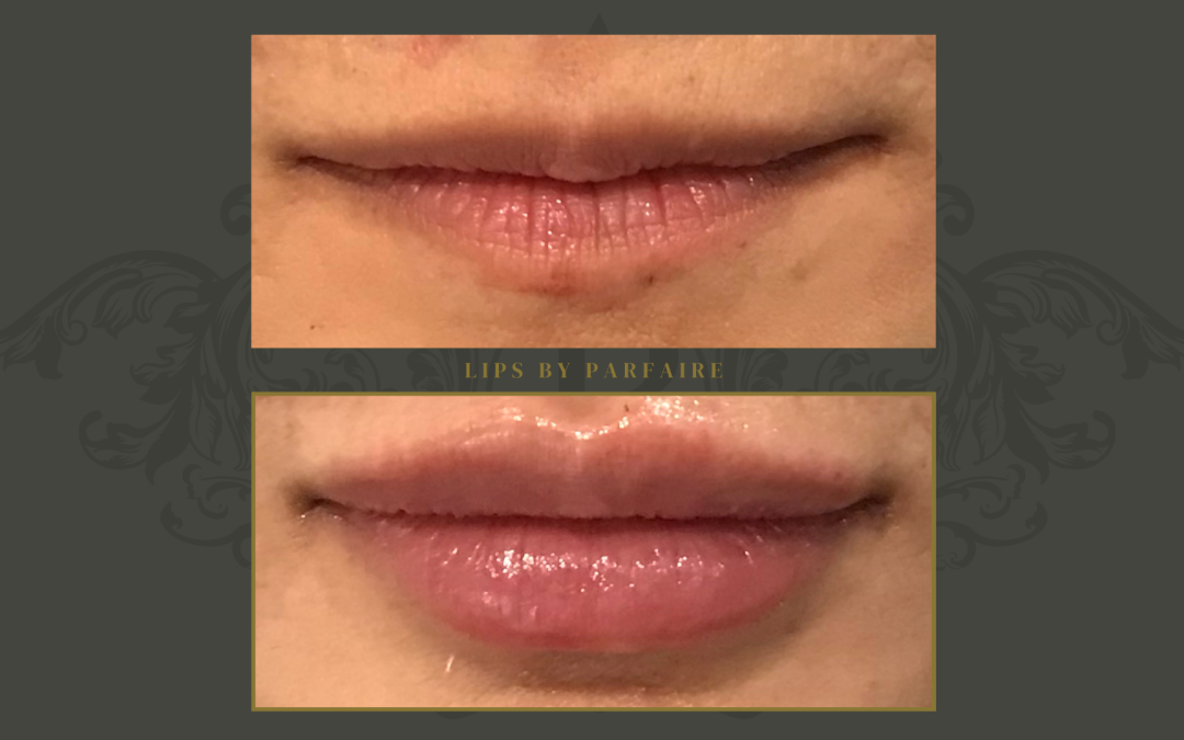 lips (3)
