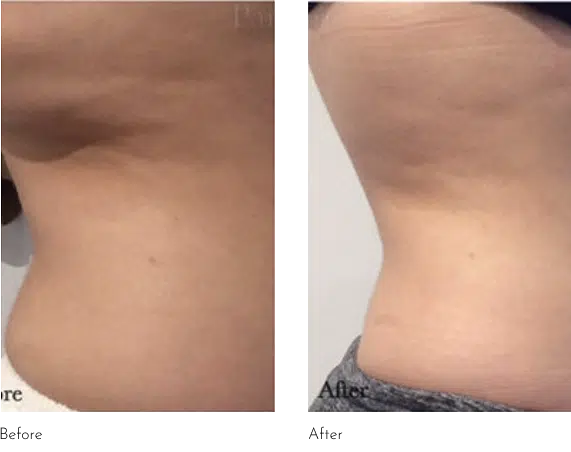 How-Tirzepatide-Works